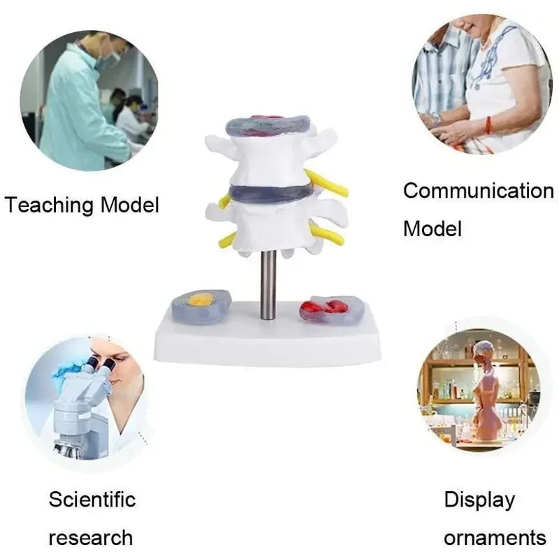 1:1 Life size Anatomical Human Lumbar Disc Herniation Demonstration Spine Anatomy Model School Training Supplies