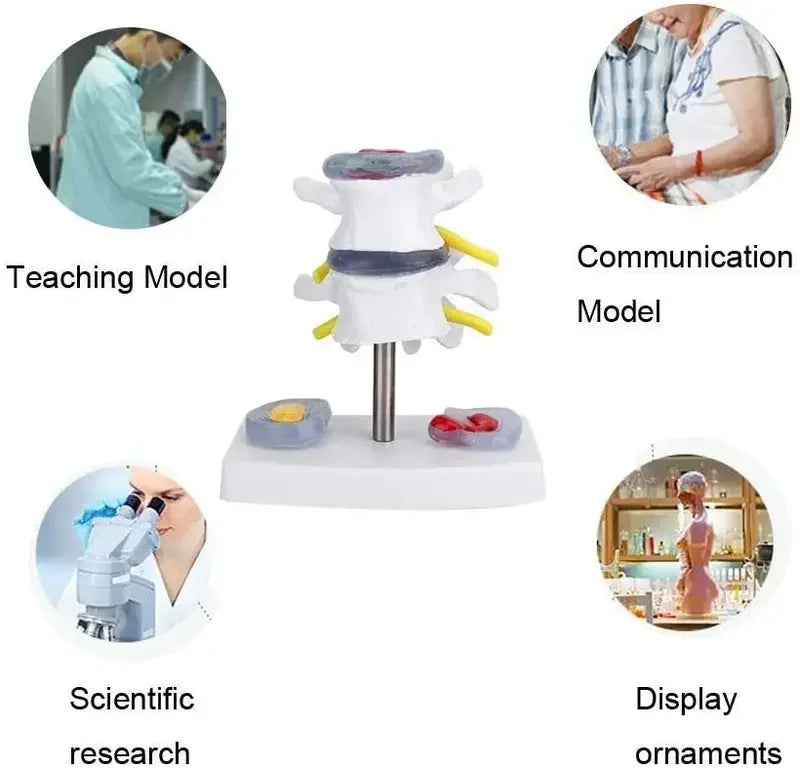 1:1 Life size Anatomical Human Lumbar Disc Herniation Demonstration Spine Anatomy Model School Training Supplies