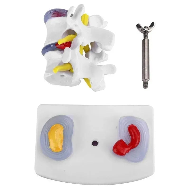 1:1 Life size Anatomical Human Lumbar Disc Herniation Demonstration Spine Anatomy Model School Training Supplies