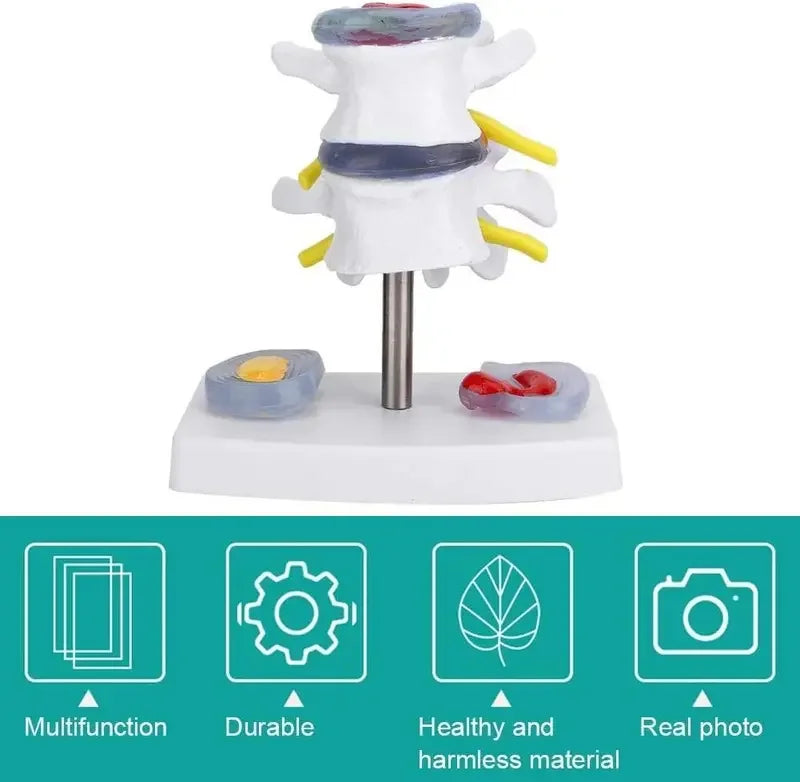1:1 Life size Anatomical Human Lumbar Disc Herniation Demonstration Spine Anatomy Model School Training Supplies