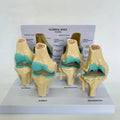 Anatomical Human Degenerative 4-stage Knee Joint Disease Model PVC Bone Medical Skeleton Anatomy Teaching Resources ﻿Wholesale